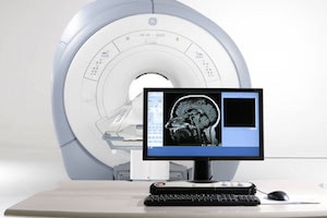 МРТ сосудов головного мозга в ОН КЛИНИК