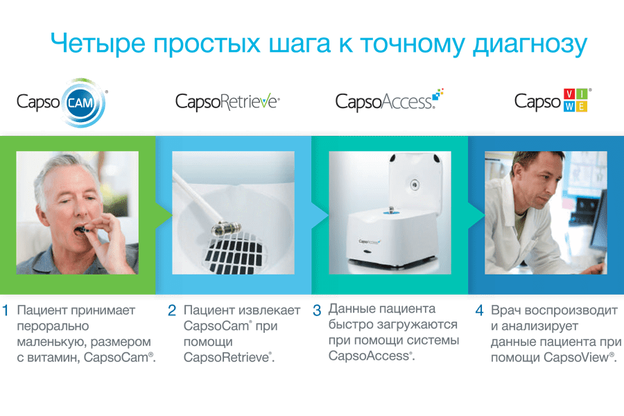 Капсульная эндоскопия - суть метода Капсульная эндоскопия - суть метода