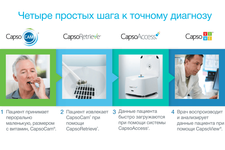 Капсульная эндоскопия - суть метода