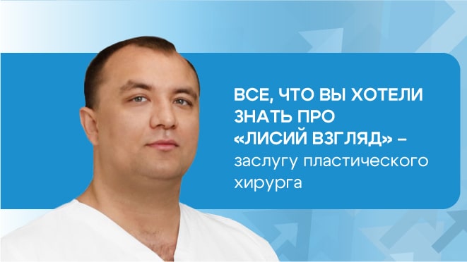 Все, что вы хотели знать про «Лисий взгляд»