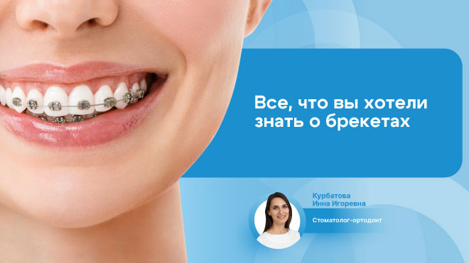 Все, что вы хотели знать о брекетах