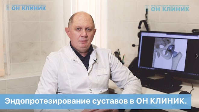 Болезнь Гоффа - причины, симптомы, диагностика, лечение и профилактика
