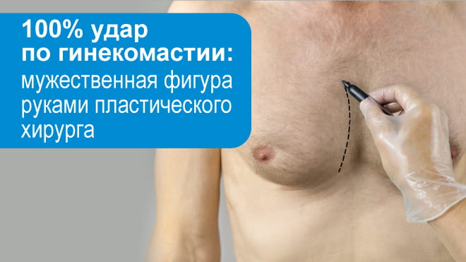 Современная пластика для мужчин против гинекомастии