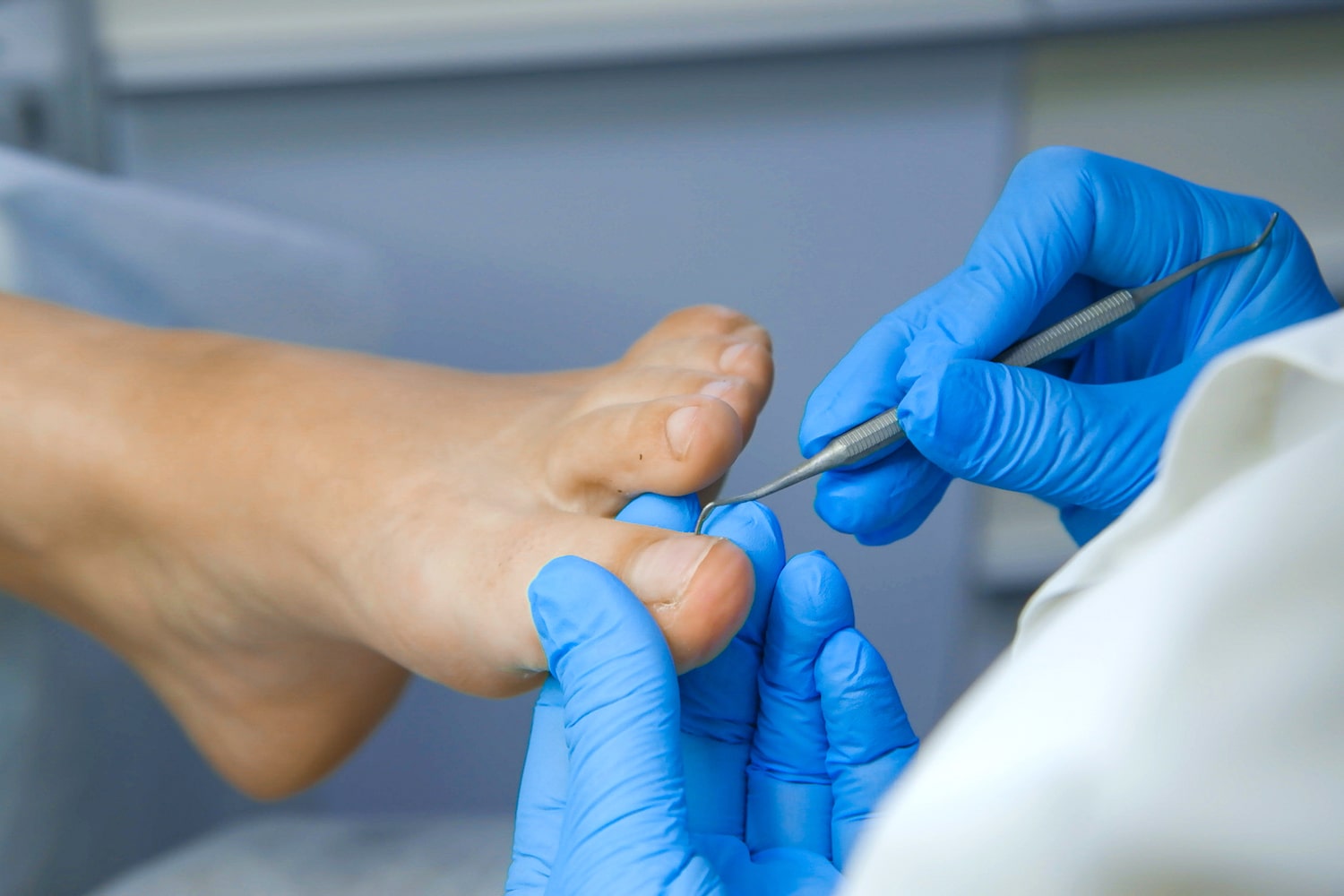 Цитологическое исследование pap тест. Подология титановая нить. Мазок из прямой кишки в больнице. Гинекология. Гинекологическое исследование девочек.