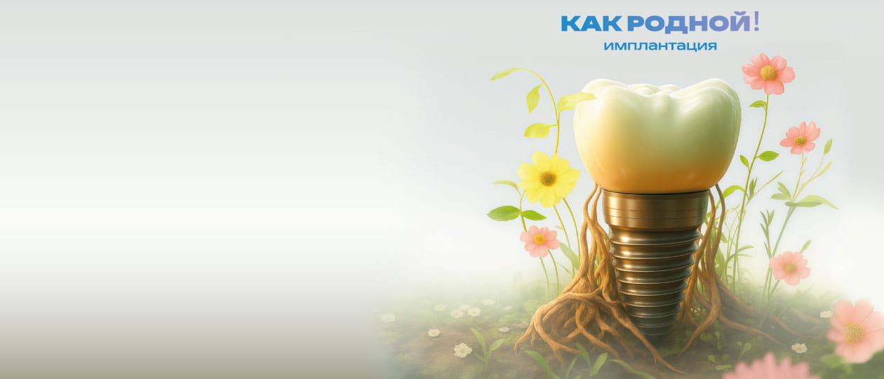 Имплантация зубов «под ключ»