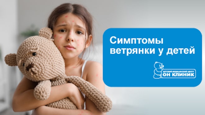 Узнайте все о ветрянке из первых уст – от опытного врача-педиатра