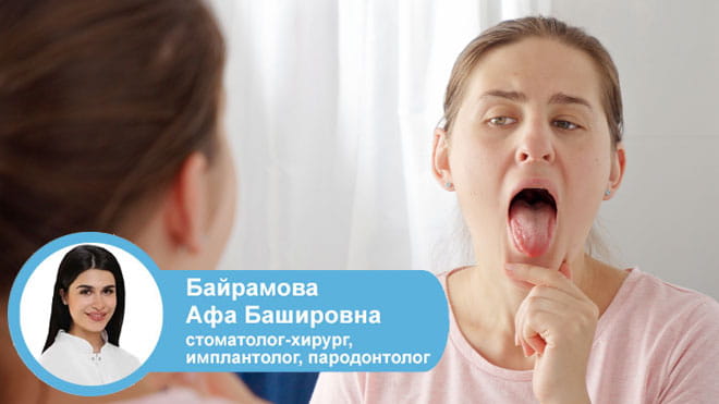 Жжение языка: 5 главных причин