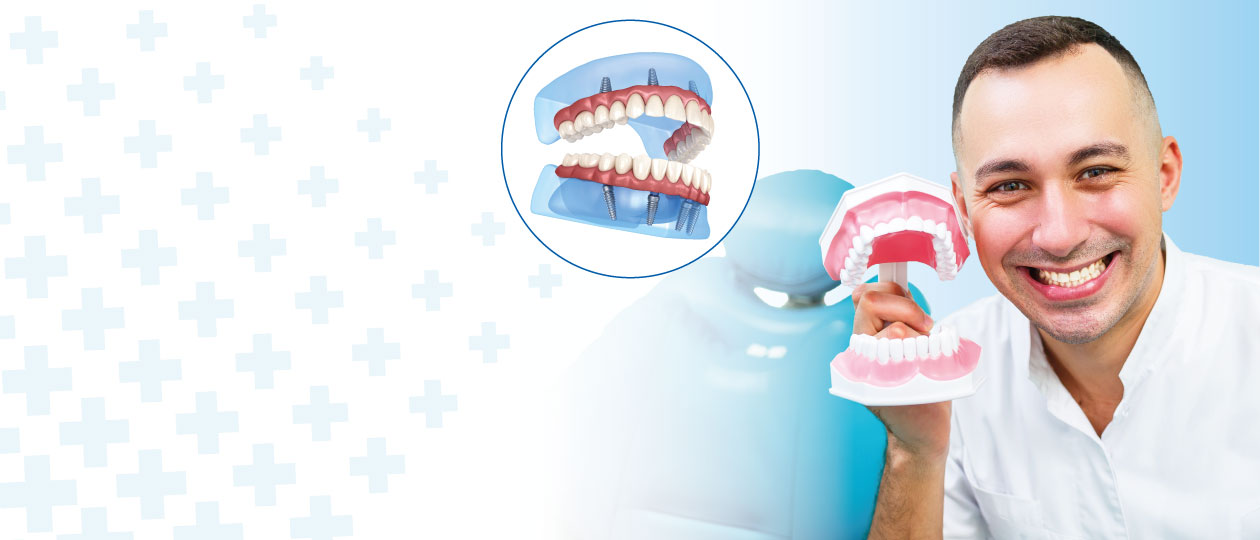 Комплекс «Зубы за один день» со скидкой 20%