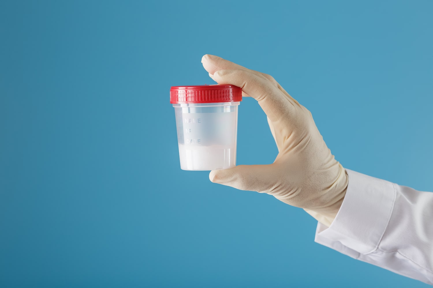 Кровь в сперме