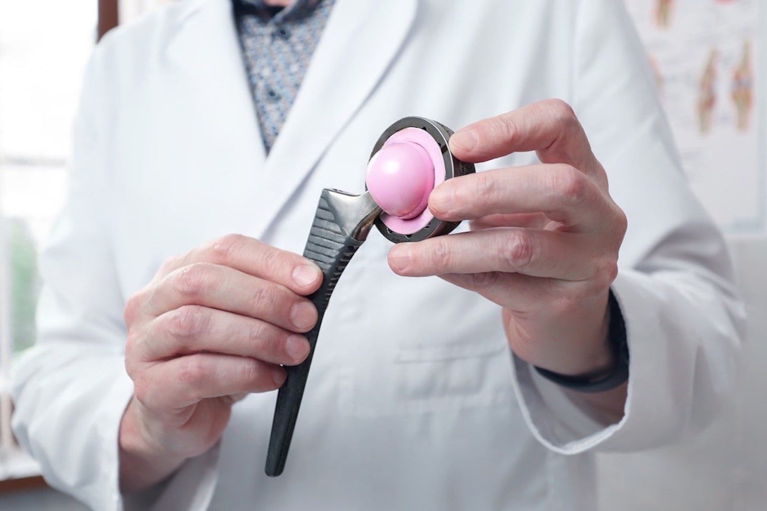 Виды эндопротезов