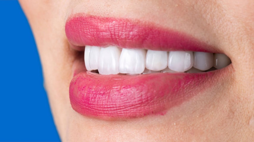 Имплантация зубов