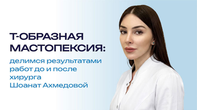 Т-образная мастопексия от Шоанат Ахмедовой помогает обрести красивую грудь