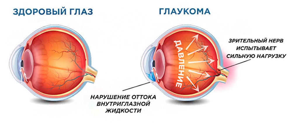 Механизм воздействия на ДЗН