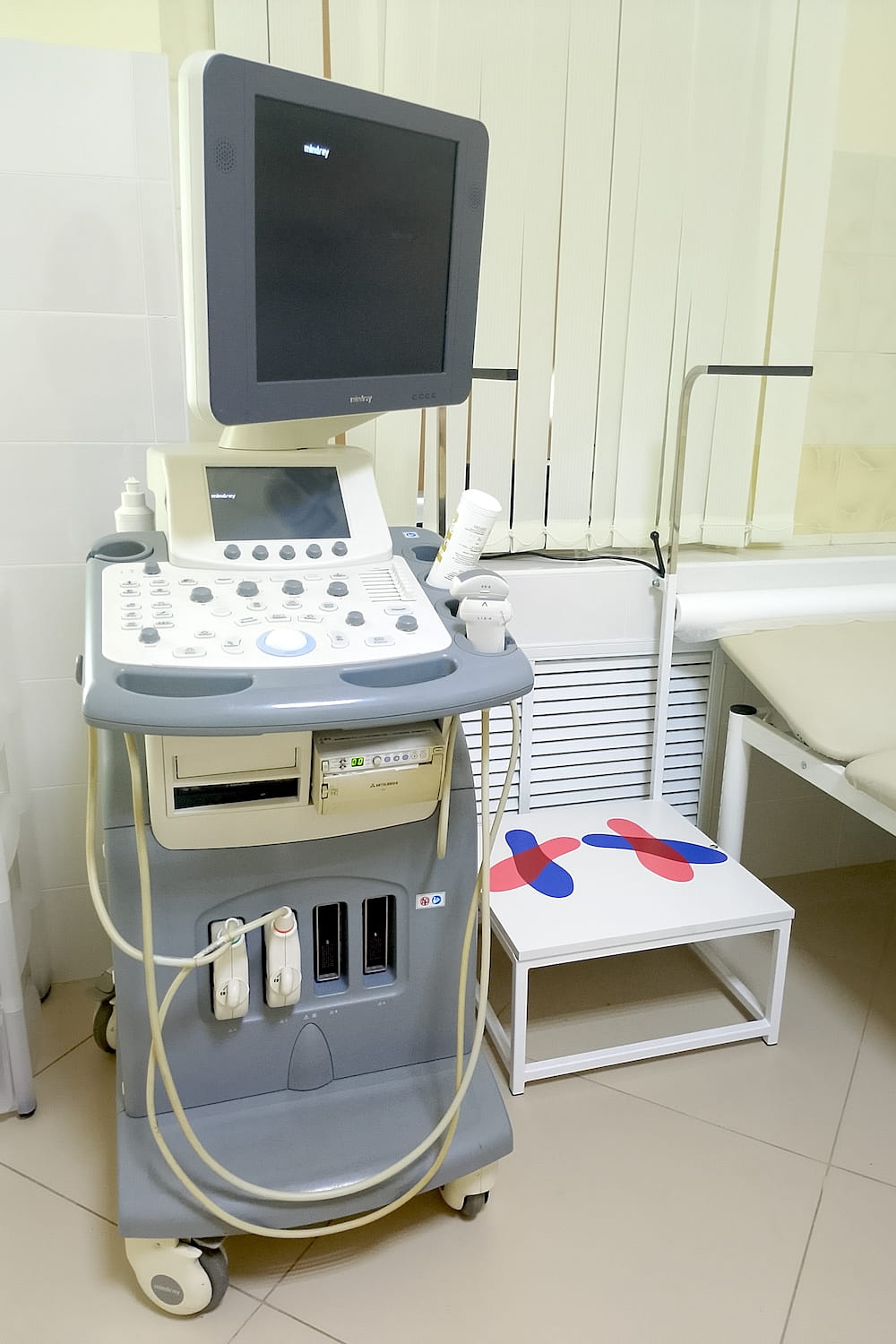 УЗИ-аппарат Mindray Philips в ОН КЛИНИК