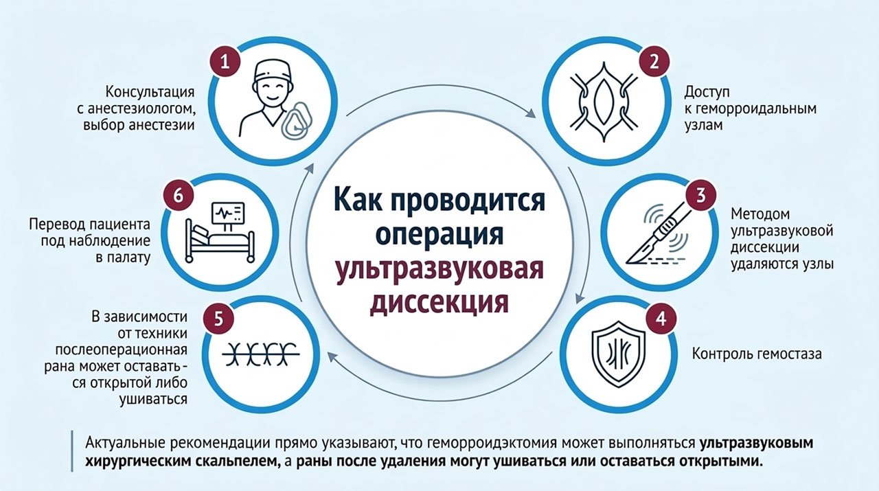 Как проводится геморроидэктомия с помощью ультразвуковой диссекции