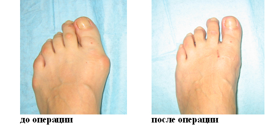 фото до и после операции фото до и после операции