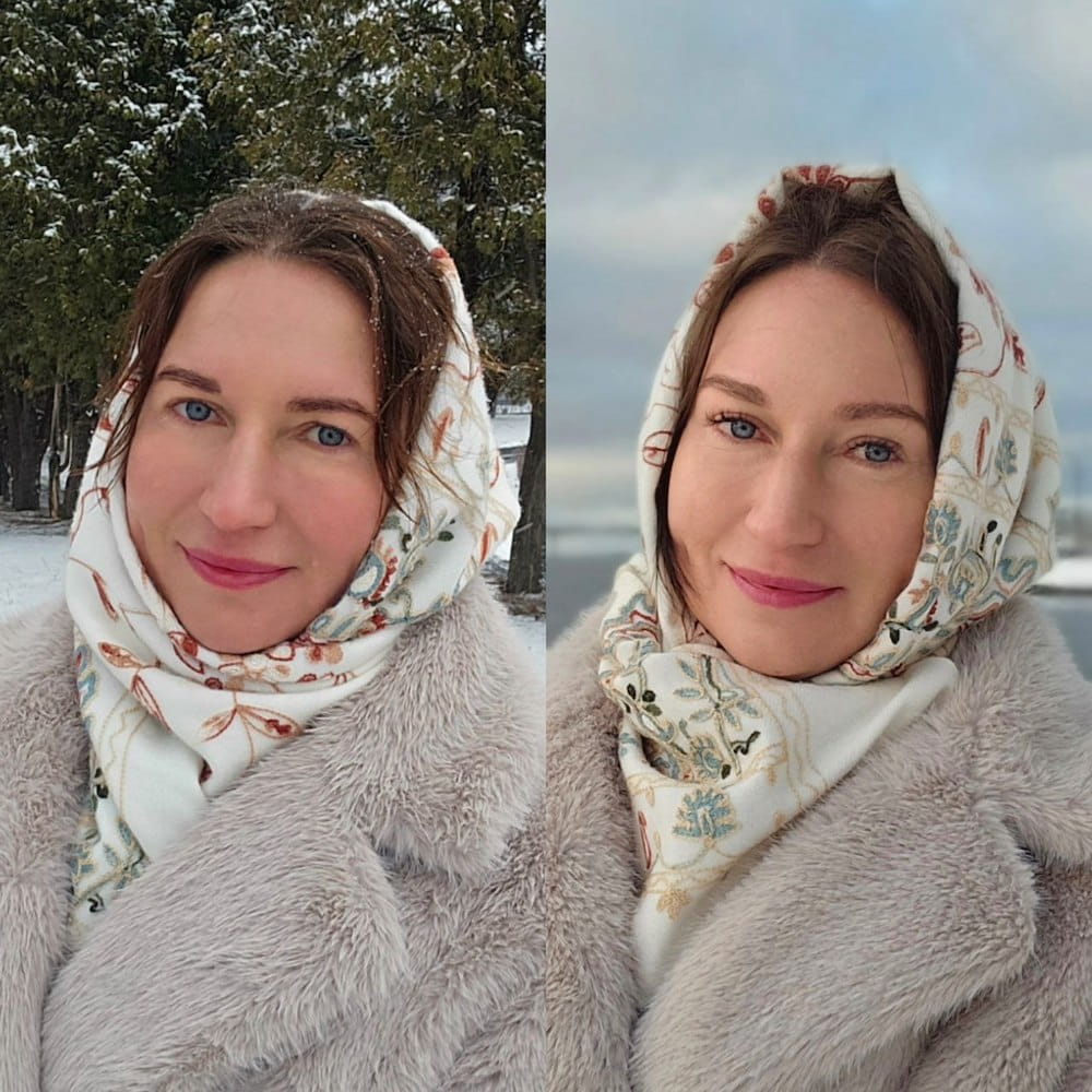 Результаты операции по омоложению лица – фото до и после. Пластический хирург ОН КЛИНИК Глебова Юлия Борисовна